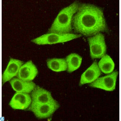 TNFRSF10B / Killer / DR5 Antibody