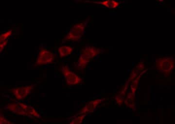 SYT1 / Synaptotagmin Antibody