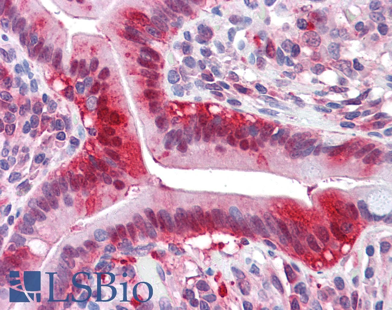 IHC-plus™ Monoclonal Mouse anti-Human LDHA / LDH1 Antibody (IHC)