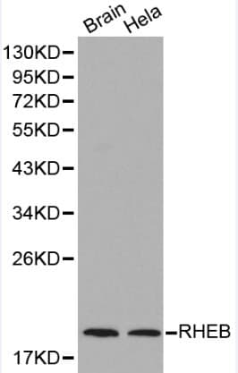 Polyclonal Rabbit anti-Human RHEB Antibody (IHC, WB)