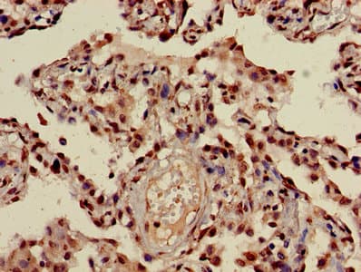 Polyclonal Rabbit anti-Human HIST1H3A Antibody (IHC, IF, WB)