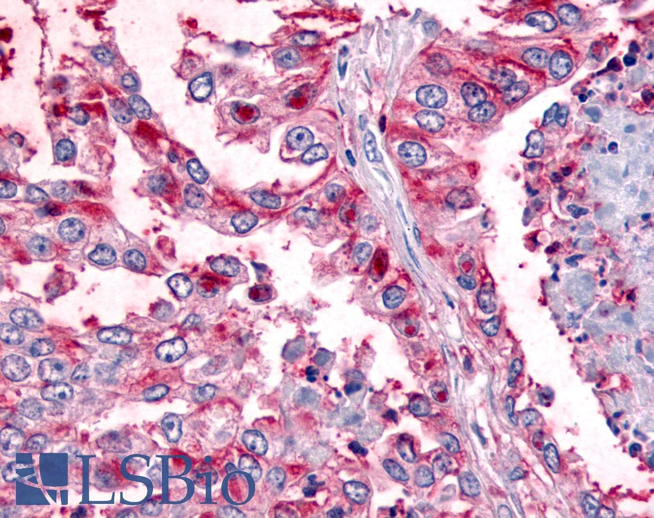 PathPlus™ WNK1 Antibody (C-Terminus)