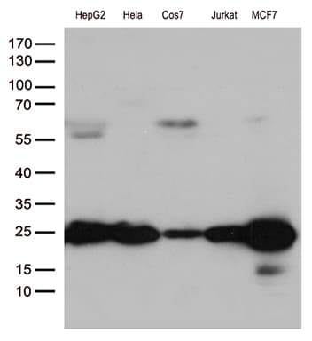 MGMT Antibody (clone OTI10H9)