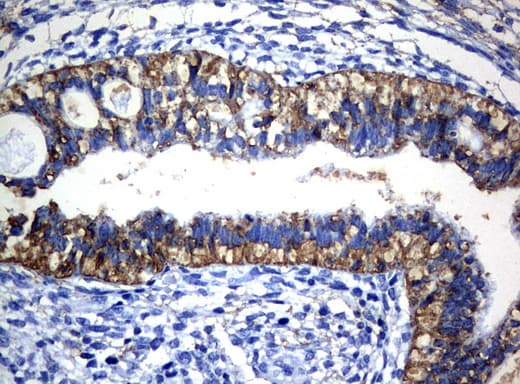 CTAG1B / NY-ESO-1 Antibody (clone UMAB72, Carrier-free)