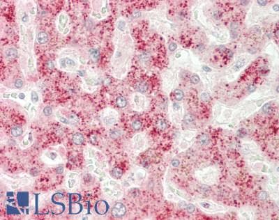 IHC-plus™ LIPC / Hepatic Lipase Antibody (aa301-350)
