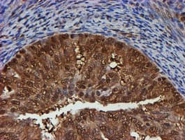 PSMB9 Antibody (aa21-219, clone OTI2G6)