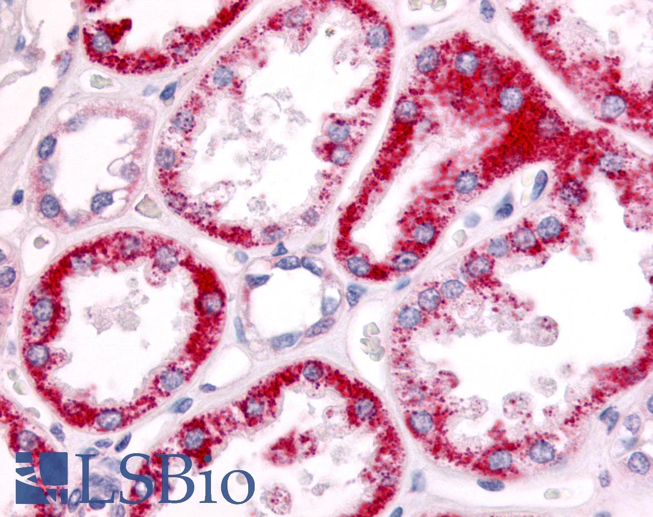 PathPlus™ SGK2 Antibody (Internal)