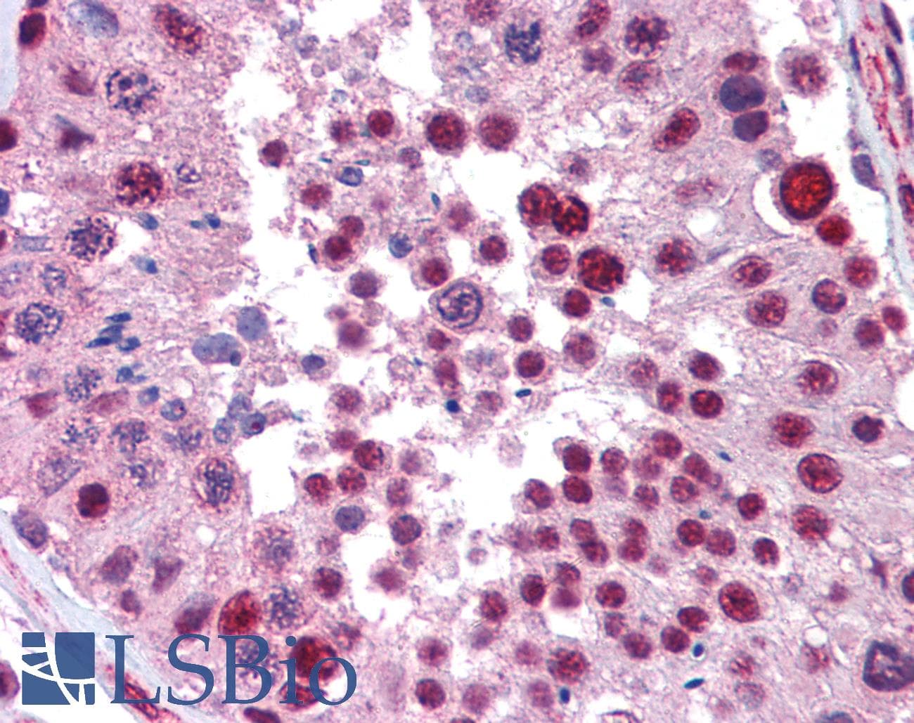 Polyclonal Rabbit anti-Human NKRF / NRF Antibody (C-Terminus, IHC, WB)