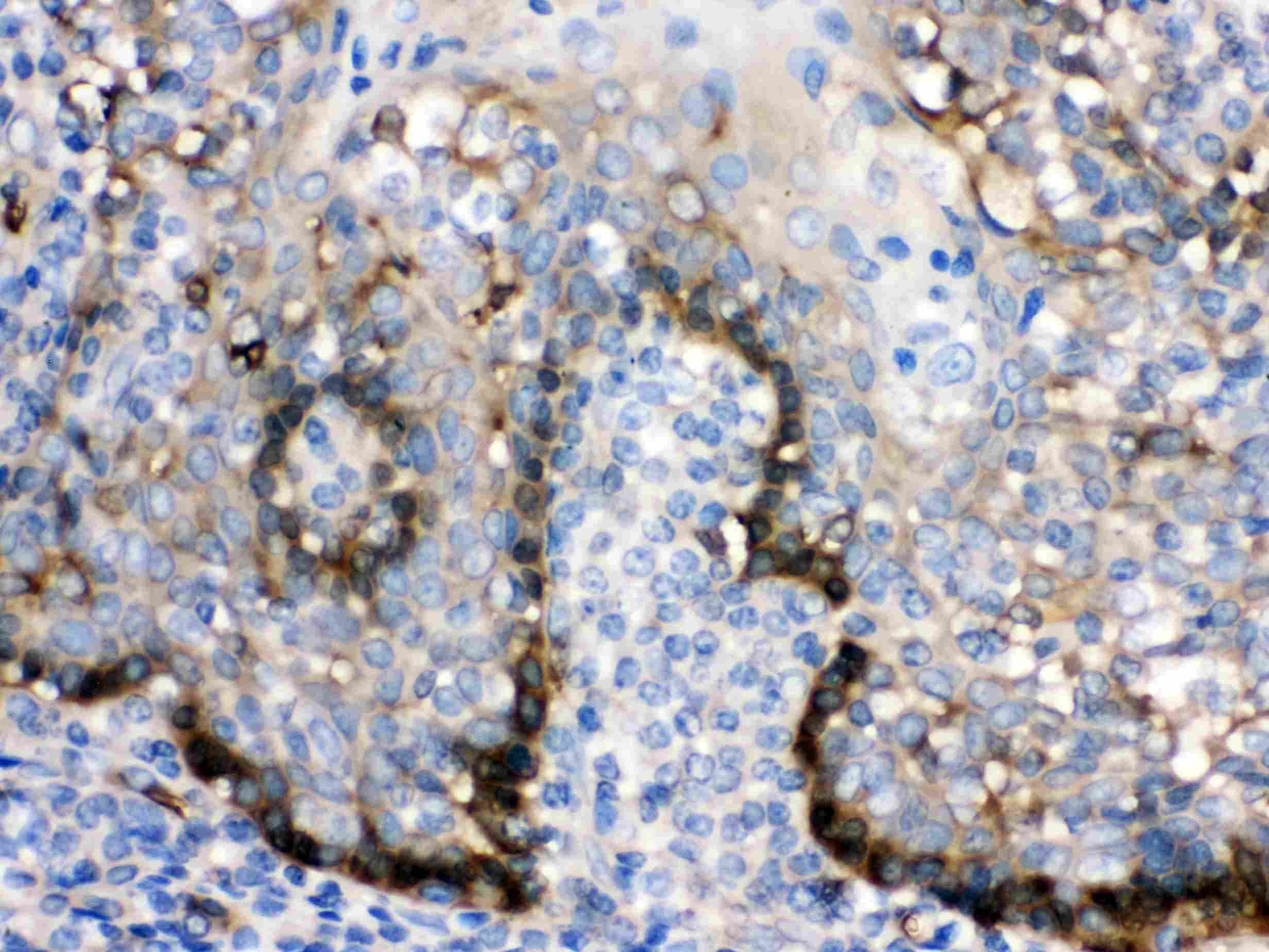 ZAP70 Antibody
