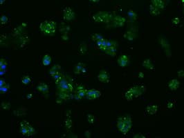 Monoclonal Mouse anti-Human APP / Beta Amyloid Precursor Antibody (clone OTI9E2, IHC, IF, WB)
