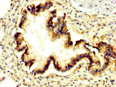 Polyclonal Rabbit anti-Human PRUNE Antibody (IHC)