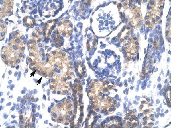 Polyclonal Rabbit anti-Human PSMC3 Antibody (aa293-339, IHC, WB)