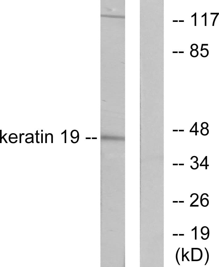 IHC-plus™ KRT19 / CK19 / Cytokeratin 19 Antibody (aa231-280)