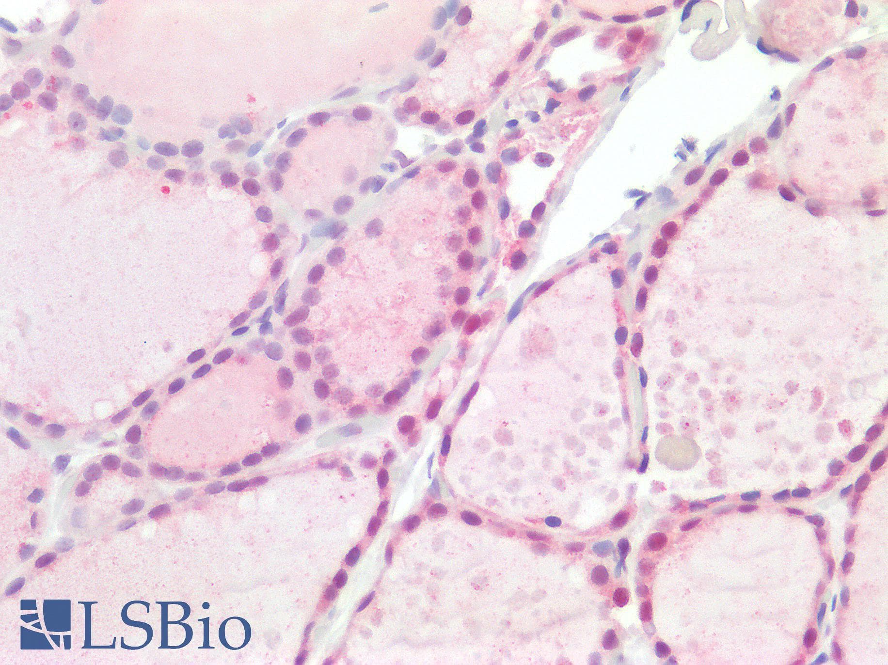 PathPlus™ SMARCB1 / INI1 Antibody