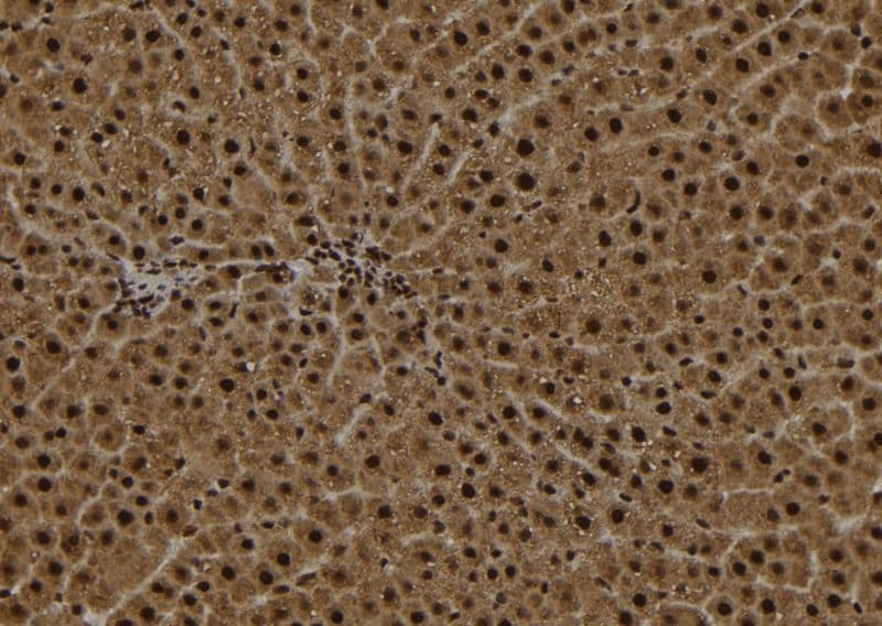 Polyclonal Rabbit anti-Human OGDH Antibody (IHC, WB)