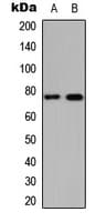 CEACAM5 / CD66e Antibody (Internal)