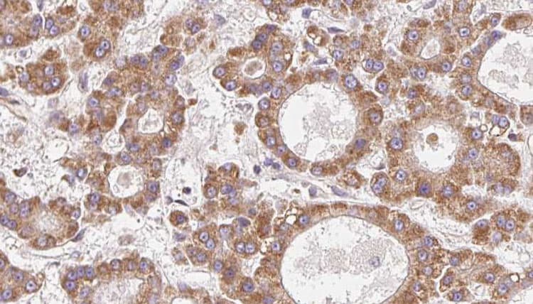 Polyclonal Rabbit anti-Human OR4N2 Antibody (IHC, WB)