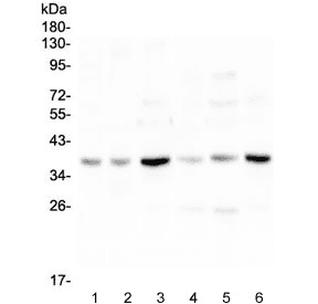 Polyclonal Rabbit anti-Human SIRT4 / Sirtuin 4 Antibody (IHC, WB)