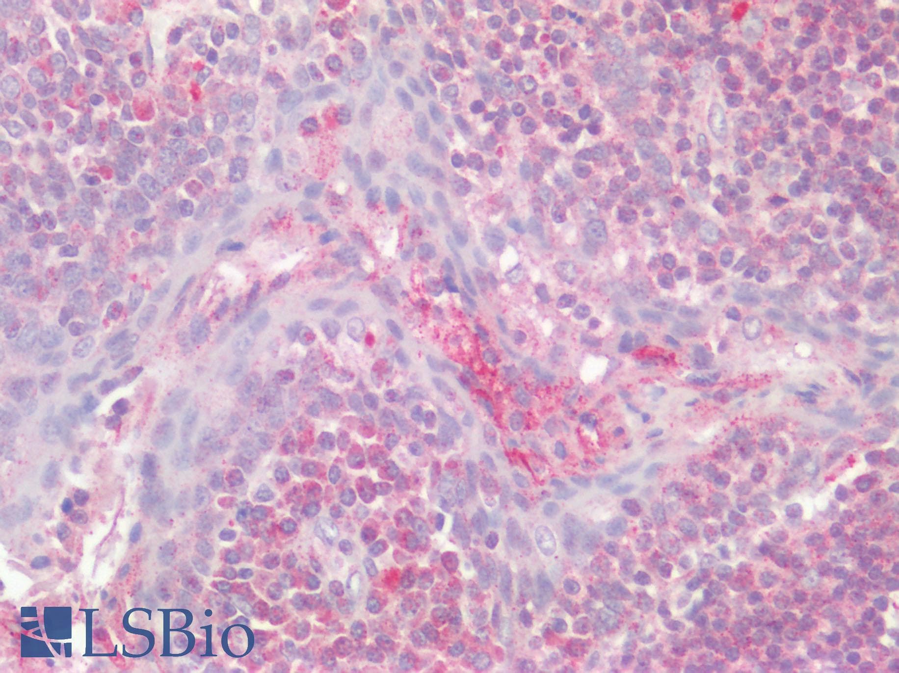 F2RL2 / PAR3 Antibody (Internal)