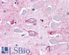 PathPlus™ MRGD / MRGPRD Antibody (Extracellular Domain)