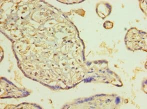 Polyclonal Rabbit anti-Human PDLIM1 Antibody (aa1-329, IHC, WB)