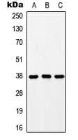 Polyclonal Rabbit anti-Human GPR171 Antibody (Internal, WB)