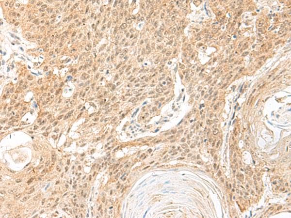 Polyclonal Rabbit anti-Human GLTSCR1 Antibody (IHC)