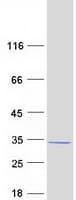Human IF3mt / MTIF3 Protein (Recombinant Myc-DDK (Flag))