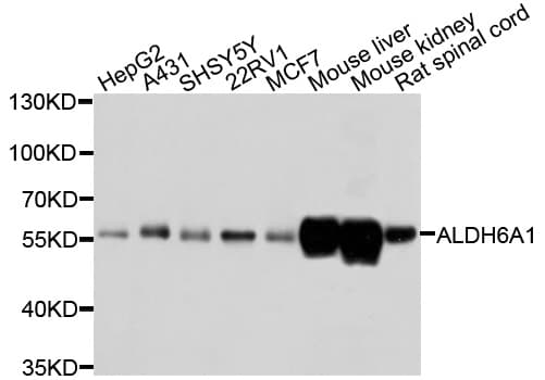 Polyclonal Rabbit anti-Human ALDH6A1 Antibody (WB)
