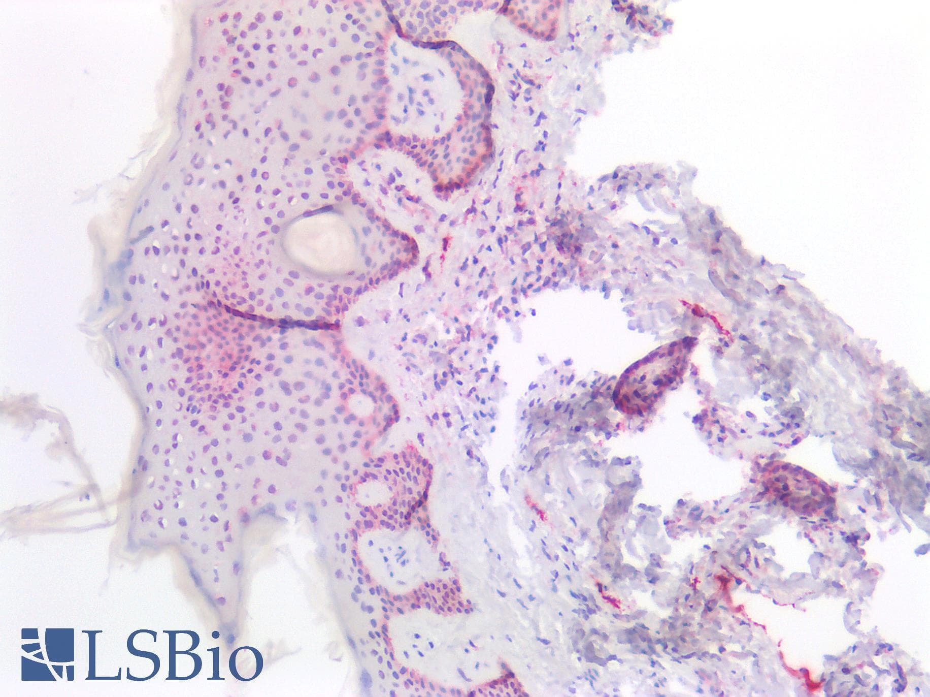 IHC-plus™ Polyclonal Rabbit anti-Human PDPN / Podoplanin Antibody (IHC, WB)