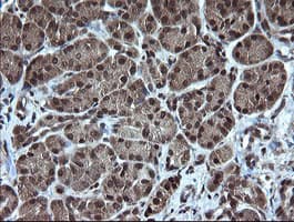 TRMT2A Antibody (clone OTI3B3)
