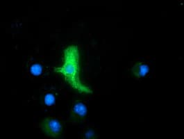 Monoclonal Mouse anti-Human MAPK7 / ERK5 Antibody (clone OTI4F9, IF, WB)