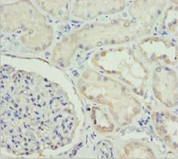 ETFA Antibody