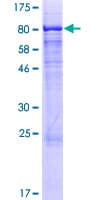 Human CSGALNACT2 Protein (Recombinant GST)