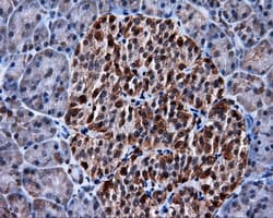 Monoclonal Mouse anti-Human MCL1 / MCL 1 Antibody (clone OTI4B7, IHC, IF, WB)