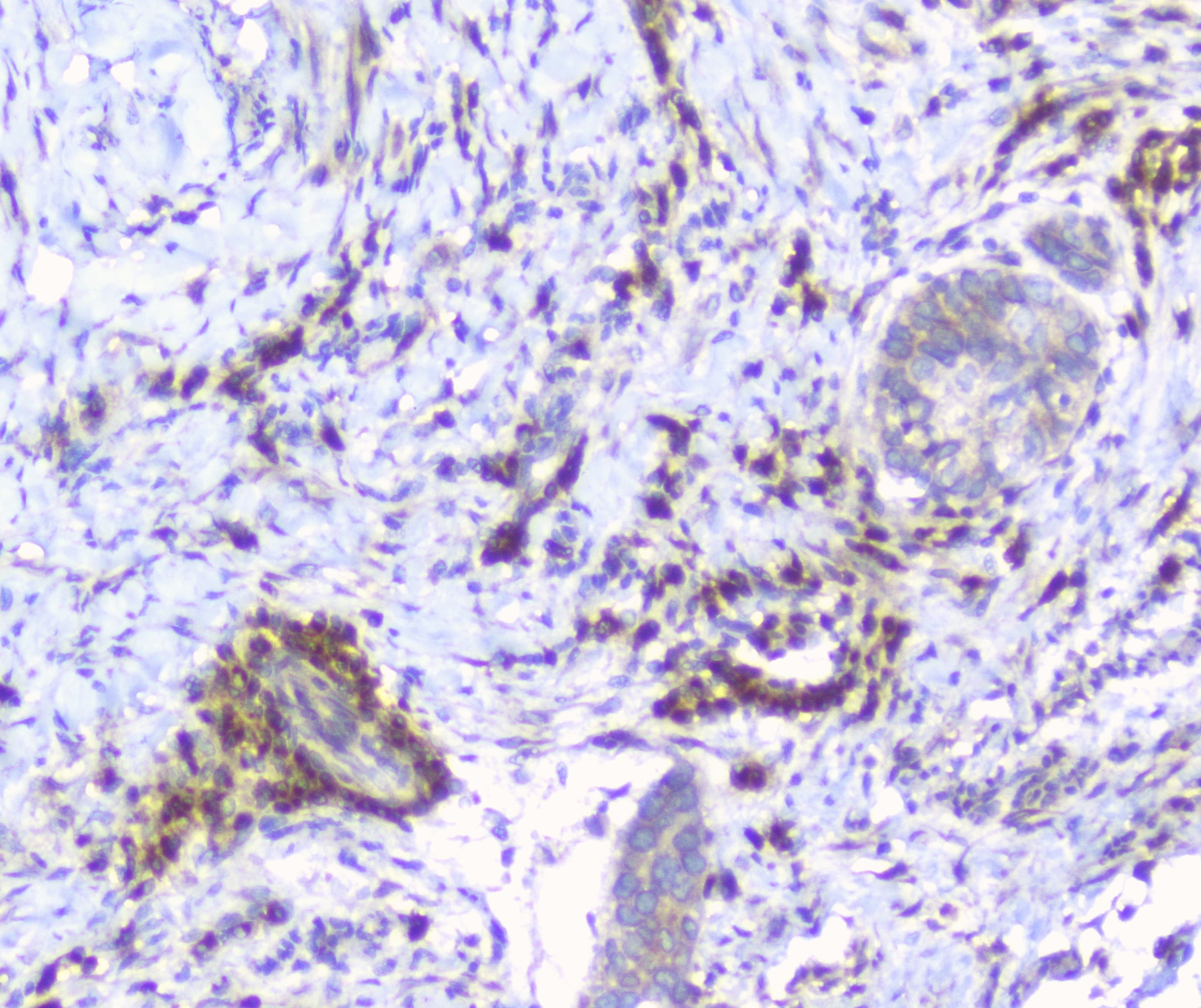 ERGIC-53 / LMAN1 Antibody