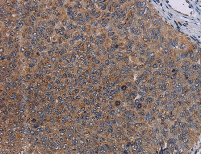 IHC-plus™ LIPE / HSL Antibody
