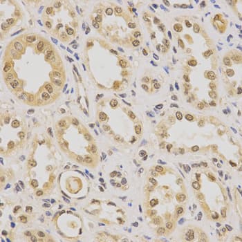 PDHA1 / PDH E1 Alpha Antibody