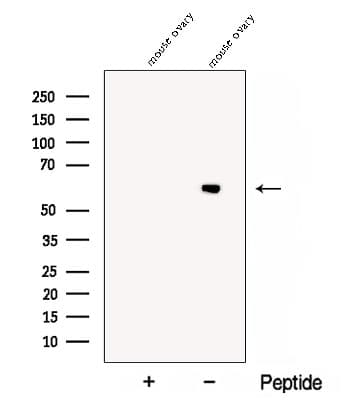 Polyclonal Rabbit anti-Human CCT6B Antibody (WB)