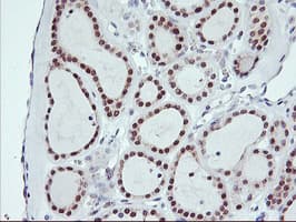 Monoclonal Mouse anti-Human USP10 Antibody (clone OTI1A10, IHC, WB)
