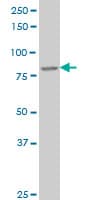 IHC-plus™ DAZ1 / DAZ Antibody (clone 3G10)