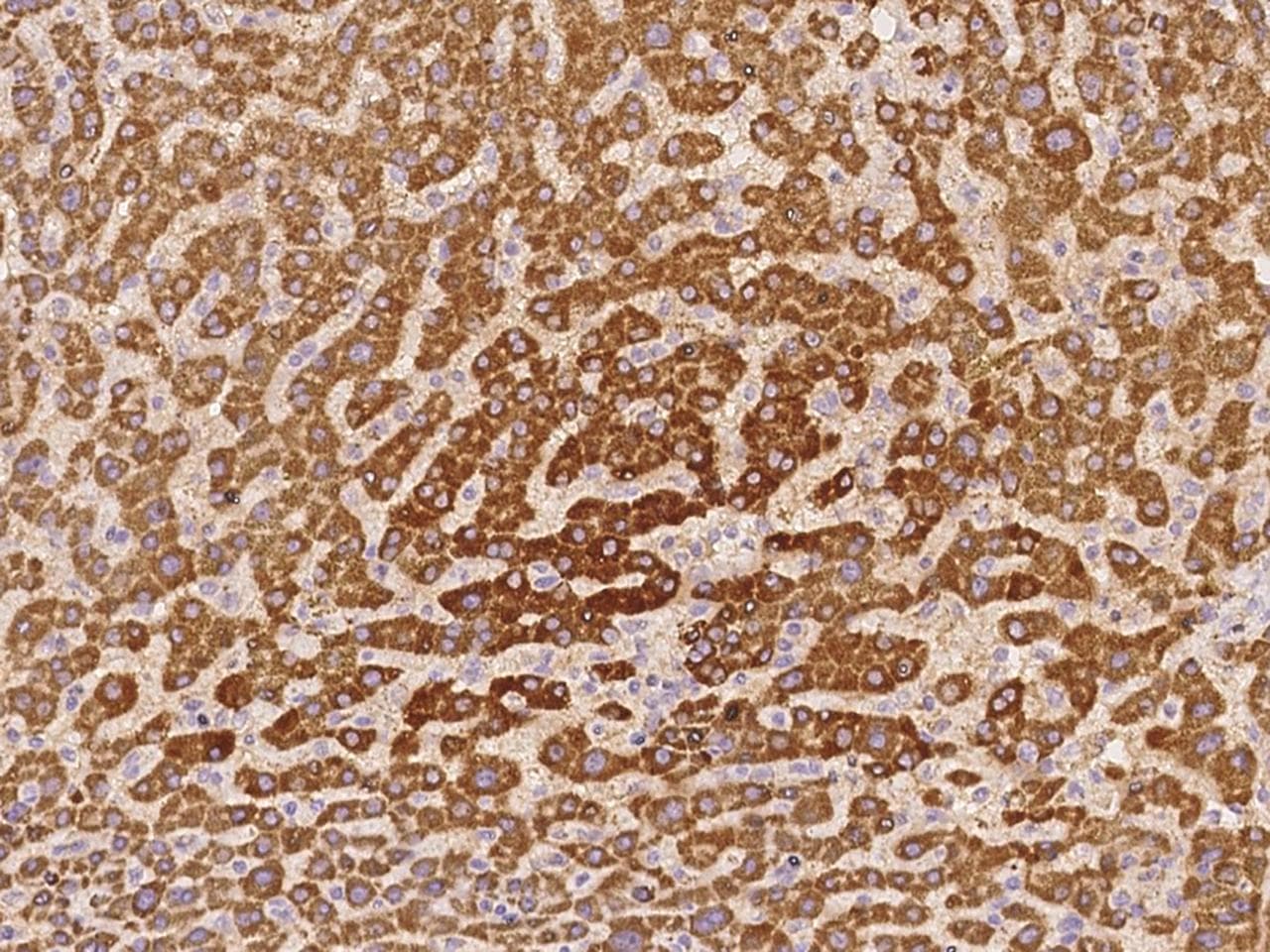 PDF / PLAB Antibody