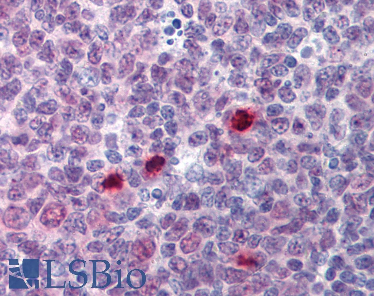 IHC-plus™ Monoclonal Mouse anti-Human ESPL1 / Separase Antibody (clone 6H6, IHC, WB)