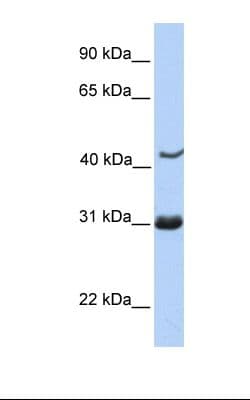 NUP35 / NUP53 Antibody (C-Terminus)