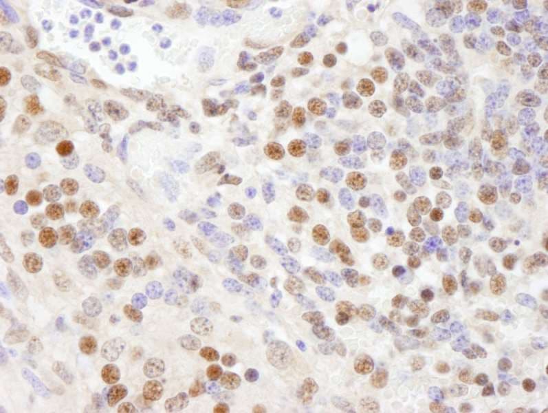 Polyclonal Rabbit anti-Human SF3A1 / SF3A120 Antibody (aa300-350, IHC, IF)