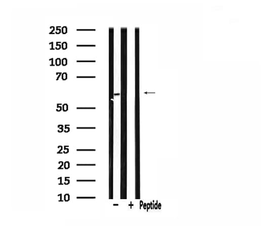 Polyclonal Rabbit anti-Human CDKAL1 Antibody (IF, WB)