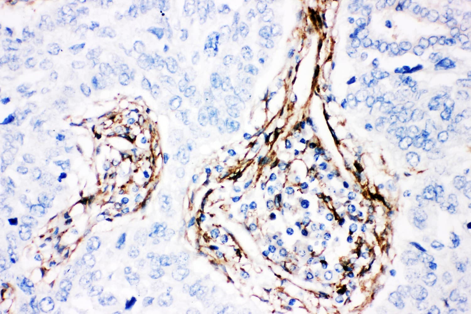Polyclonal Rabbit anti-Human CAV1 / Caveolin 1 Antibody (aa4-178, IHC, WB)