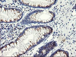 GCP60 / ACBD3 Antibody (clone OTI3E7)