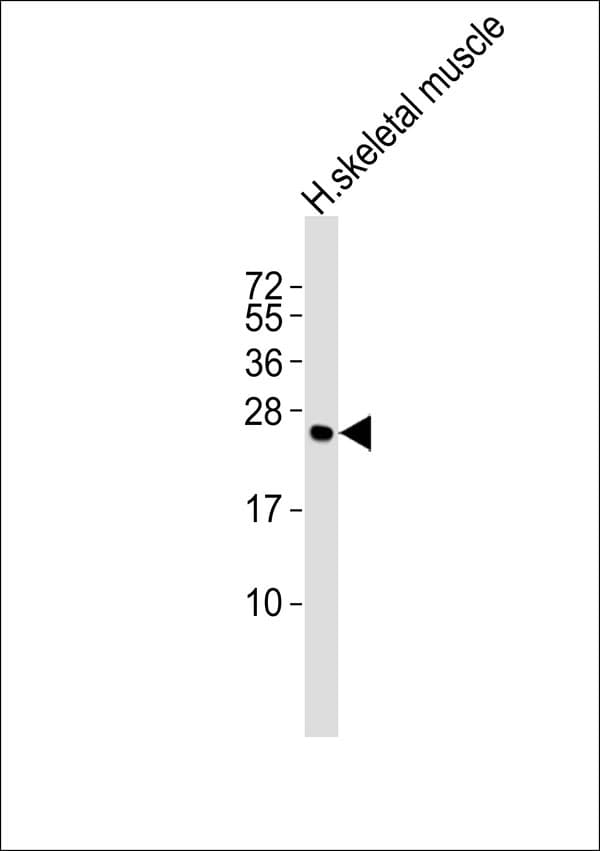 Polyclonal Rabbit anti-Human CACNG1 / CACNG Antibody (WB)