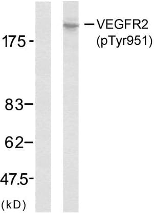 Polyclonal Rabbit anti-Human KDR / VEGFR2 / FLK1 Antibody (phospho-Tyr951, IHC, WB)